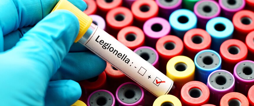 Legionella Risk Assessment Service